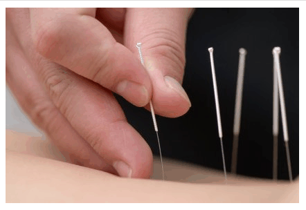 Stylo d'Acupuncture SuJok en acier inoxydable, outil de massage