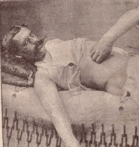 Krammgriff, Massage abdominal